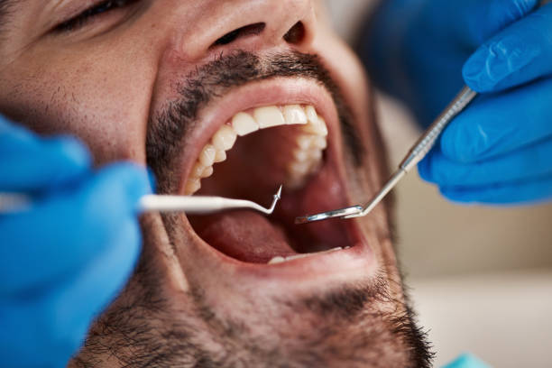 Best Emergency Dentist Open Today  in Pleasant Hill, OH