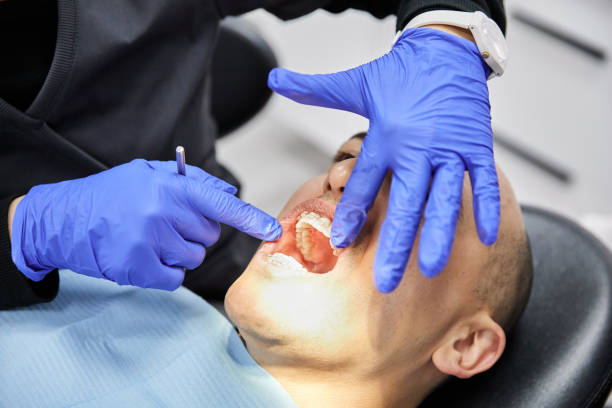 Best Broken Tooth Emergency  in Pleasant Hill, OH